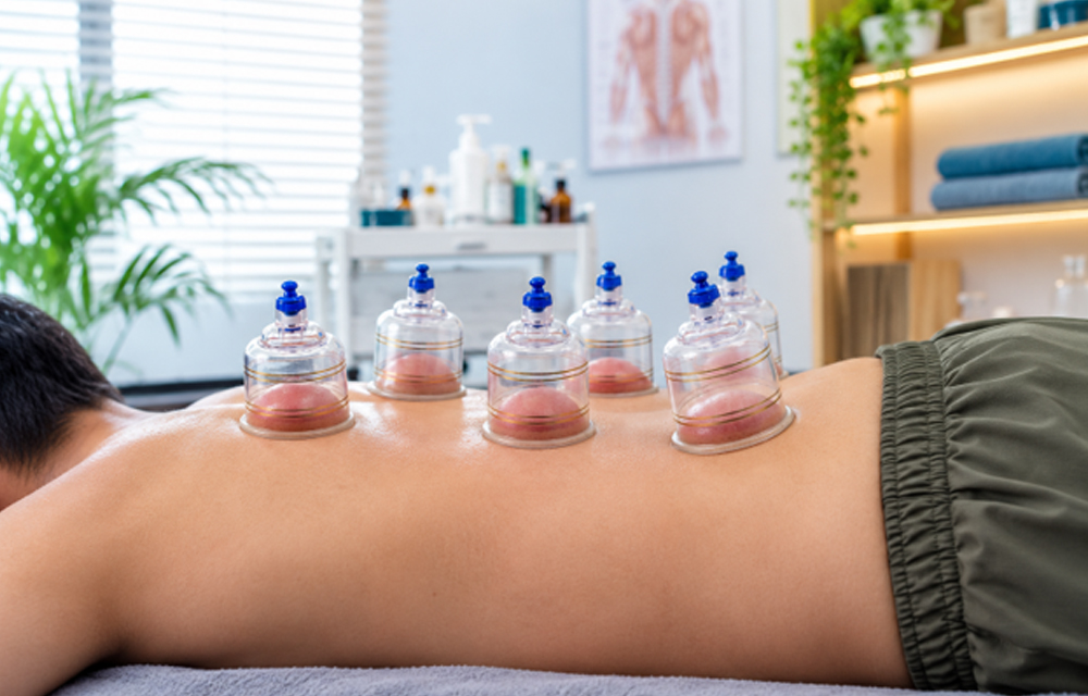 Best-Cupping-Therapy-in-Dubai-A-Modern-Approach-to-Recovery,-Relief-and-Wellness